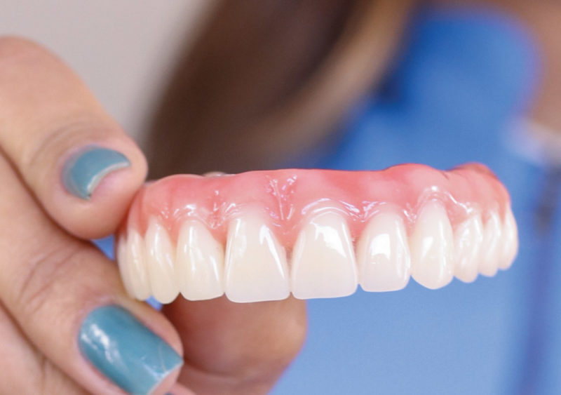 What are Dentures? - Baldwin Family Dental